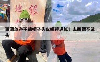 西藏旅游不戴帽子头皮晒得通红？去西藏不洗头